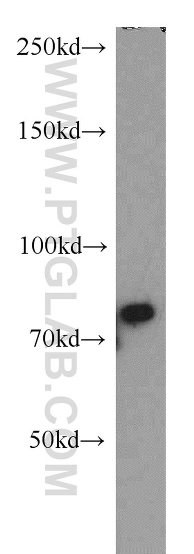 FUS/TLS Antibody in Western Blot (WB)