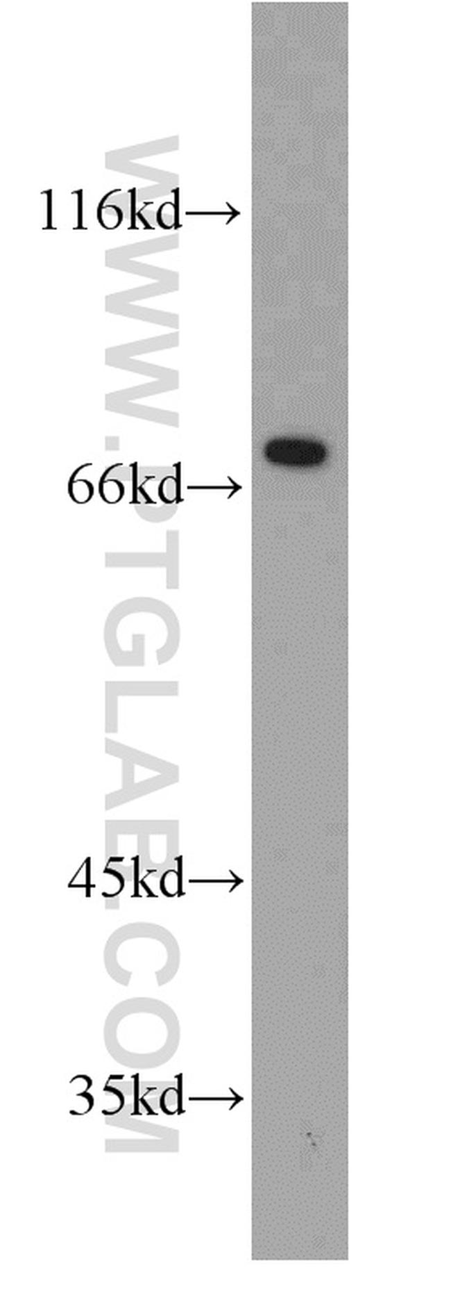 FUS/TLS Antibody in Western Blot (WB)