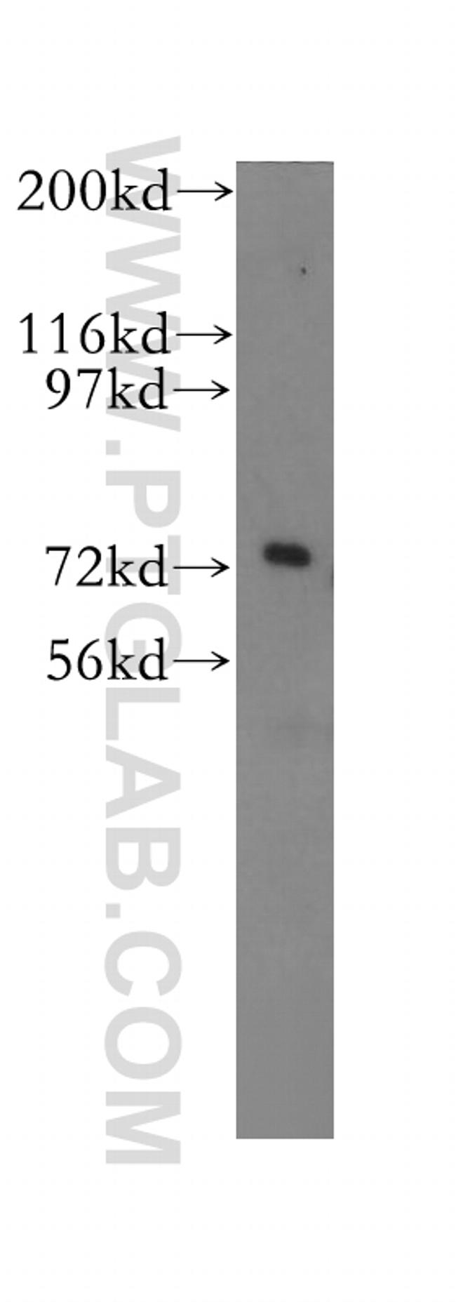 FUS/TLS Antibody in Western Blot (WB)