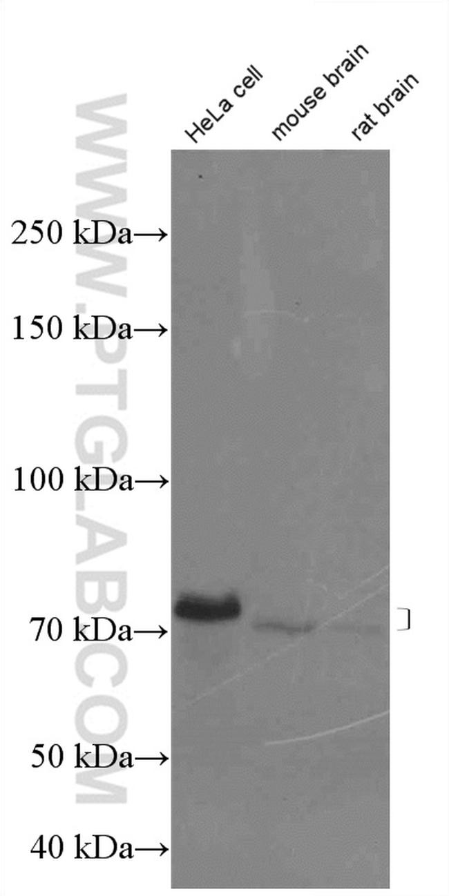 FUS/TLS Antibody in Western Blot (WB)