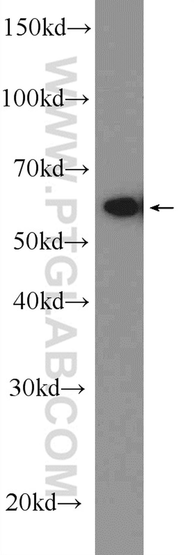 FUS/TLS Antibody in Western Blot (WB)