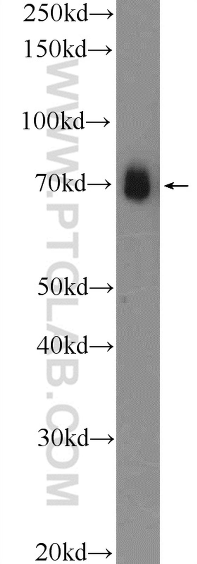 FUS/TLS Antibody in Western Blot (WB)