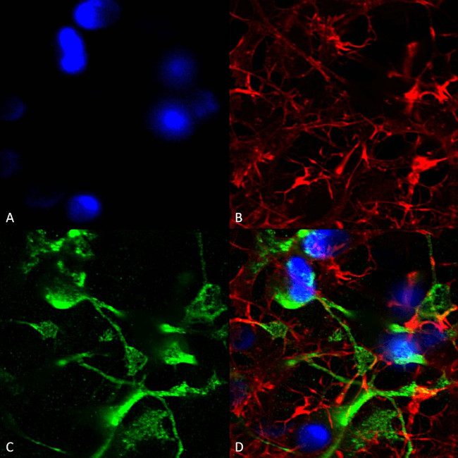 SUR2A Antibody in Immunocytochemistry (ICC/IF)