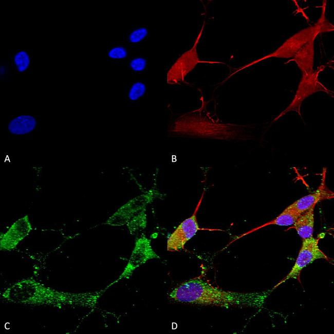 TARP2/4/8/Stargazin Antibody in Immunocytochemistry (ICC/IF)