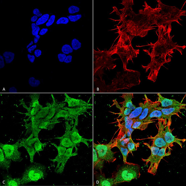 TARP2/4/8/Stargazin Antibody in Immunocytochemistry (ICC/IF)