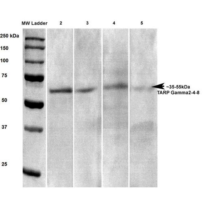 TARP2/4/8/Stargazin Antibody in Western Blot (WB)