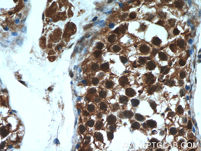 PSMA6 Antibody in Immunohistochemistry (Paraffin) (IHC (P))