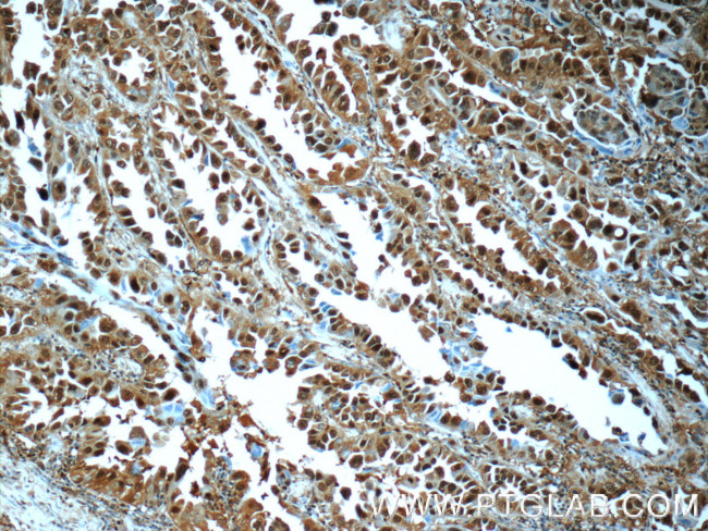 PSMA6 Antibody in Immunohistochemistry (Paraffin) (IHC (P))