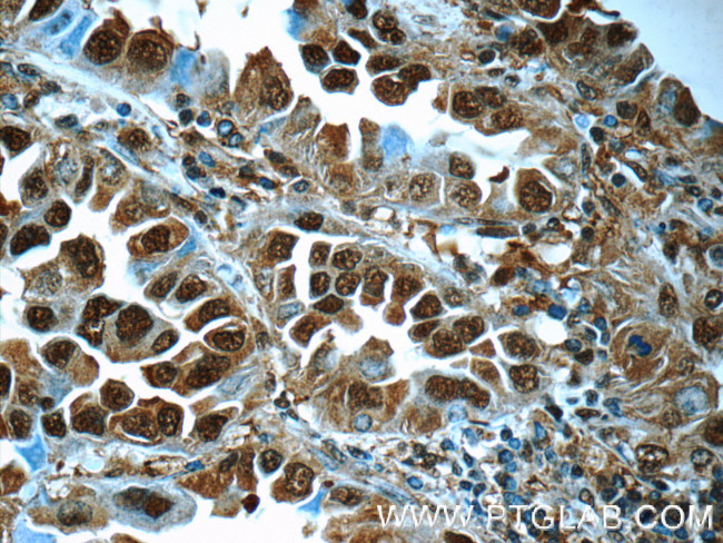 PSMA6 Antibody in Immunohistochemistry (Paraffin) (IHC (P))