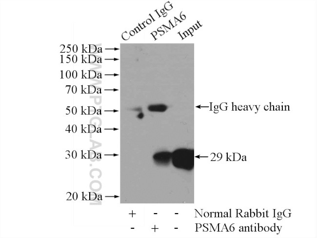 PSMA6 Antibody in Immunoprecipitation (IP)