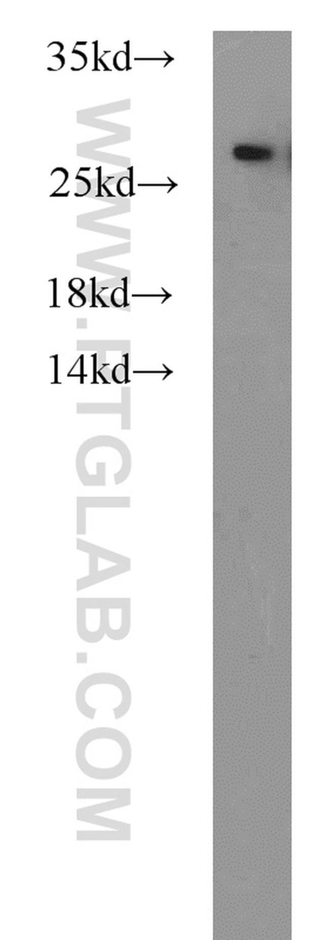 PSMA6 Antibody in Western Blot (WB)