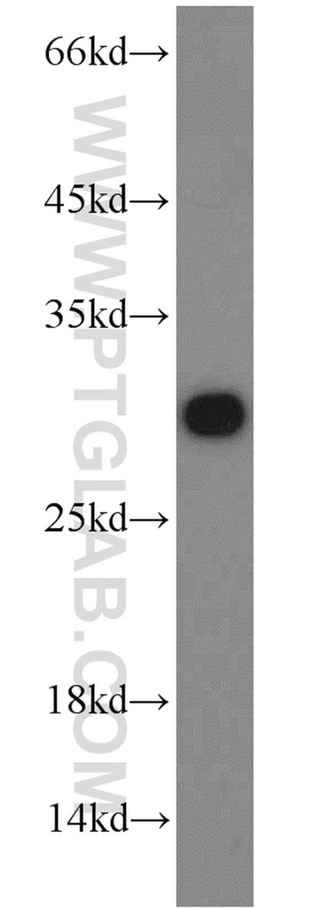 PSMA6 Antibody in Western Blot (WB)