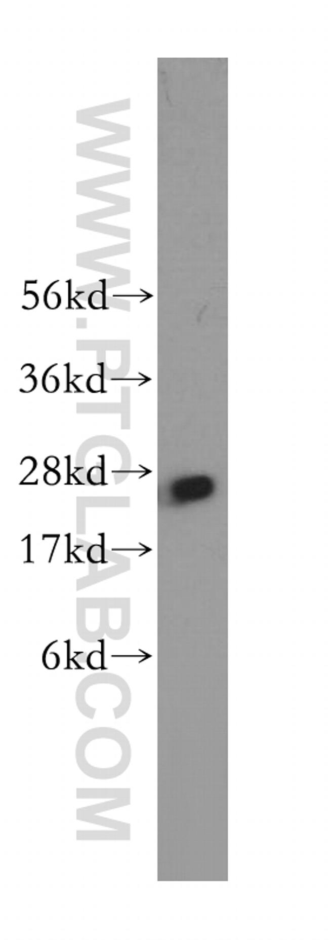 PSMA6 Antibody in Western Blot (WB)