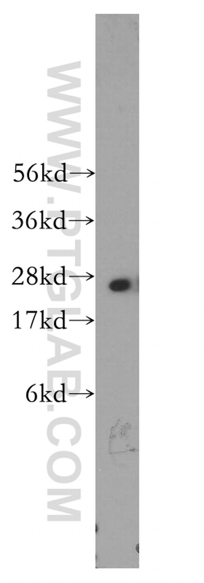 PSMA6 Antibody in Western Blot (WB)