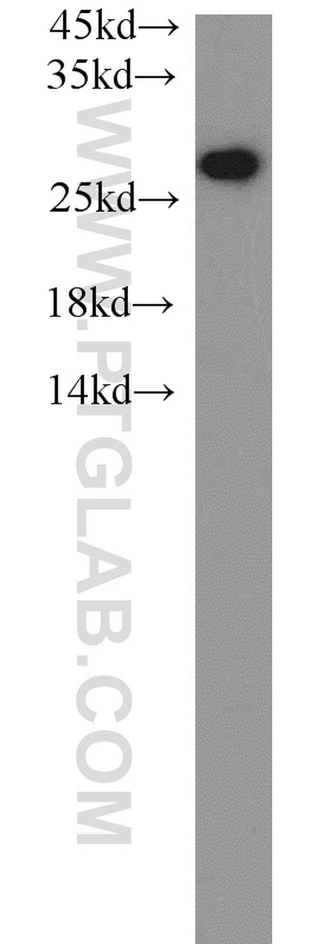 PSMA6 Antibody in Western Blot (WB)