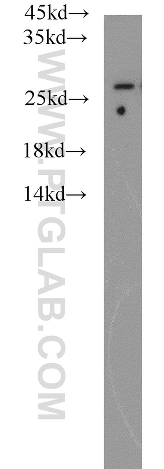 PSMA6 Antibody in Western Blot (WB)