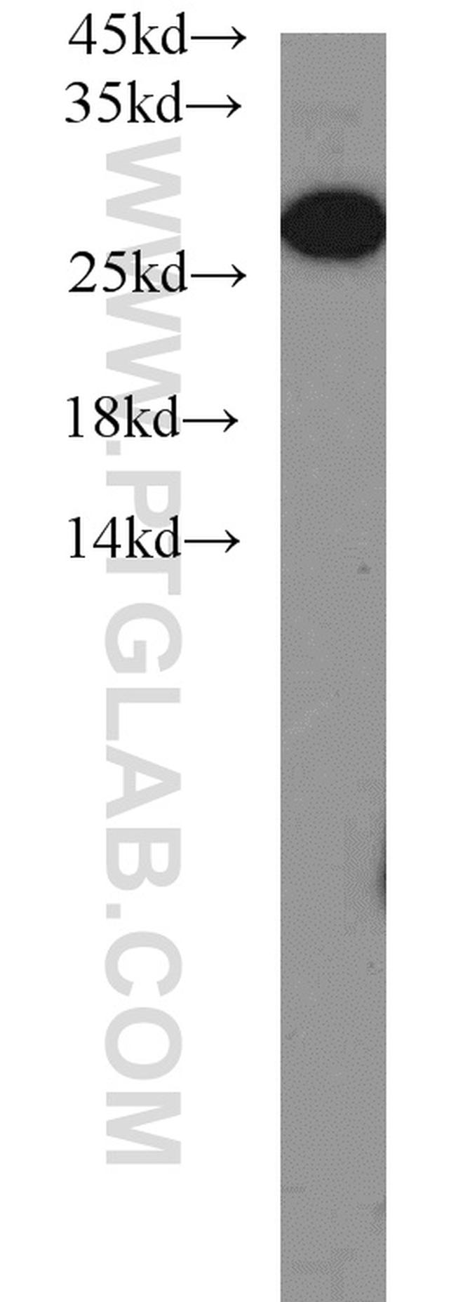 PSMA6 Antibody in Western Blot (WB)