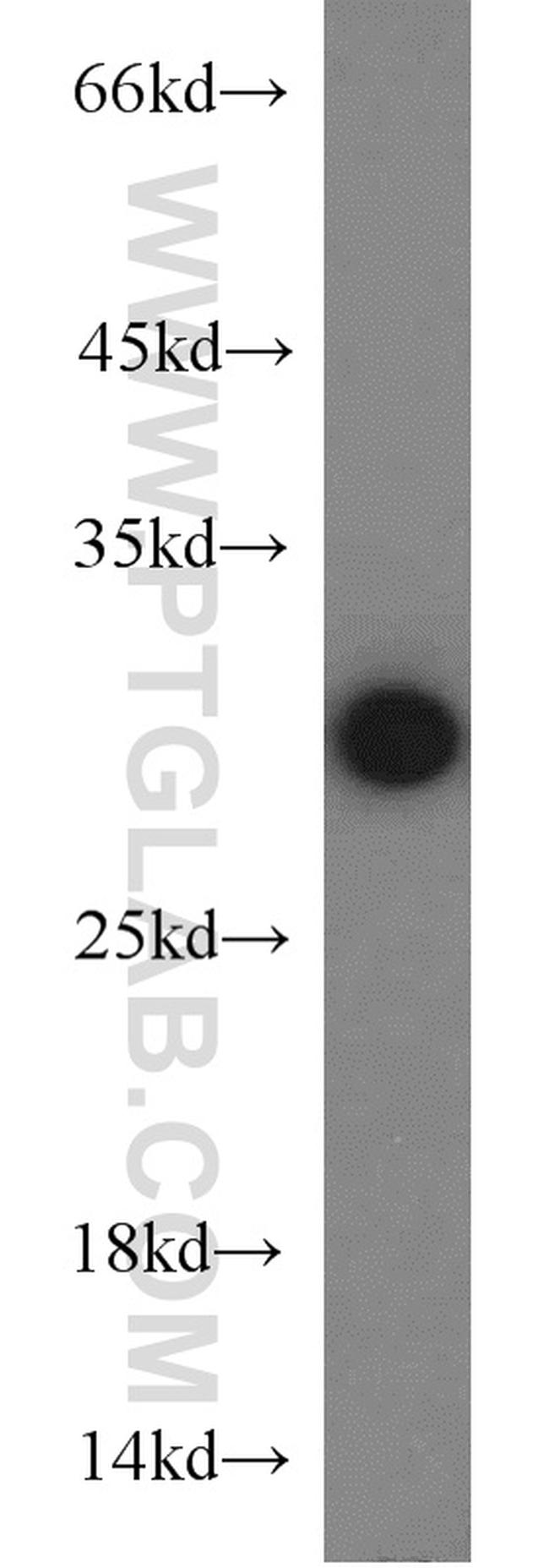 PSMA6 Antibody in Western Blot (WB)