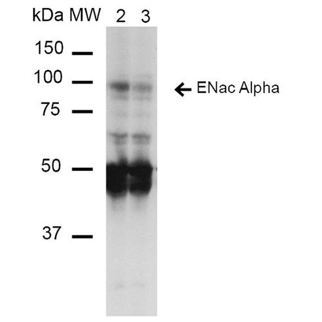 ENaC alpha Antibody in Western Blot (WB)