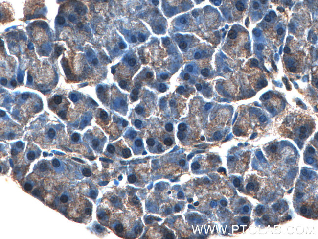 OGT Antibody in Immunohistochemistry (Paraffin) (IHC (P))