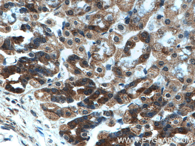 OGT Antibody in Immunohistochemistry (Paraffin) (IHC (P))