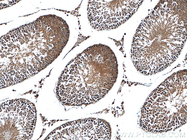 OGT Antibody in Immunohistochemistry (Paraffin) (IHC (P))