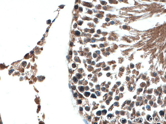 OGT Antibody in Immunohistochemistry (Paraffin) (IHC (P))