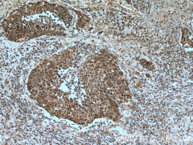 OGT Antibody in Immunohistochemistry (Paraffin) (IHC (P))