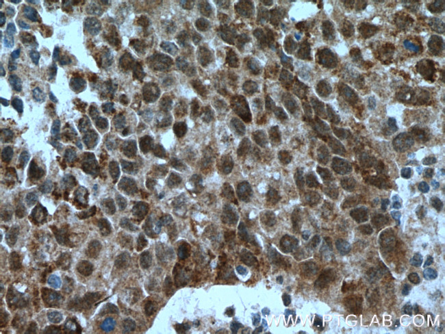 OGT Antibody in Immunohistochemistry (Paraffin) (IHC (P))