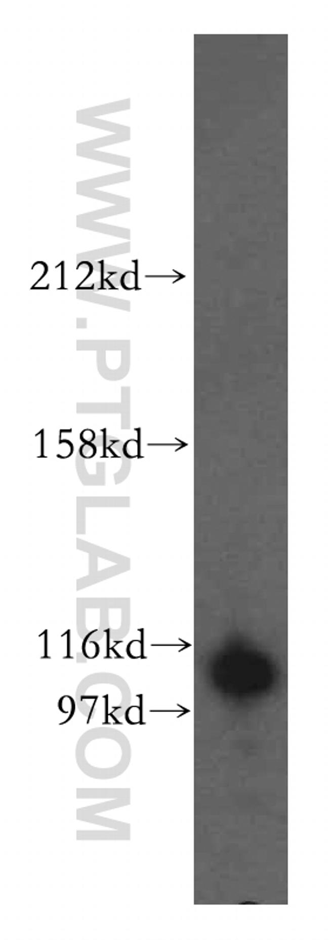 OGT Antibody in Western Blot (WB)