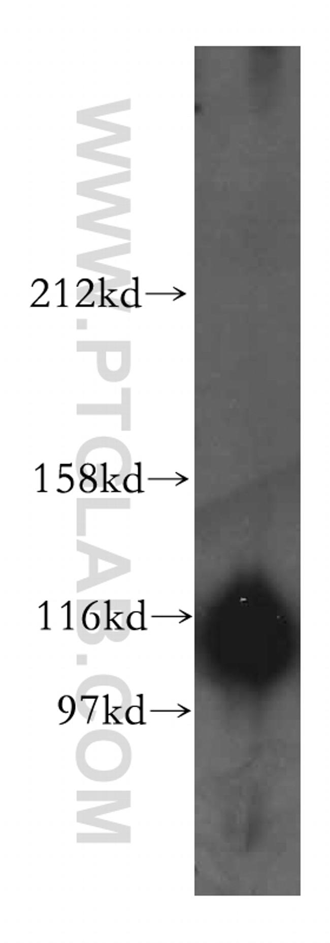 OGT Antibody in Western Blot (WB)