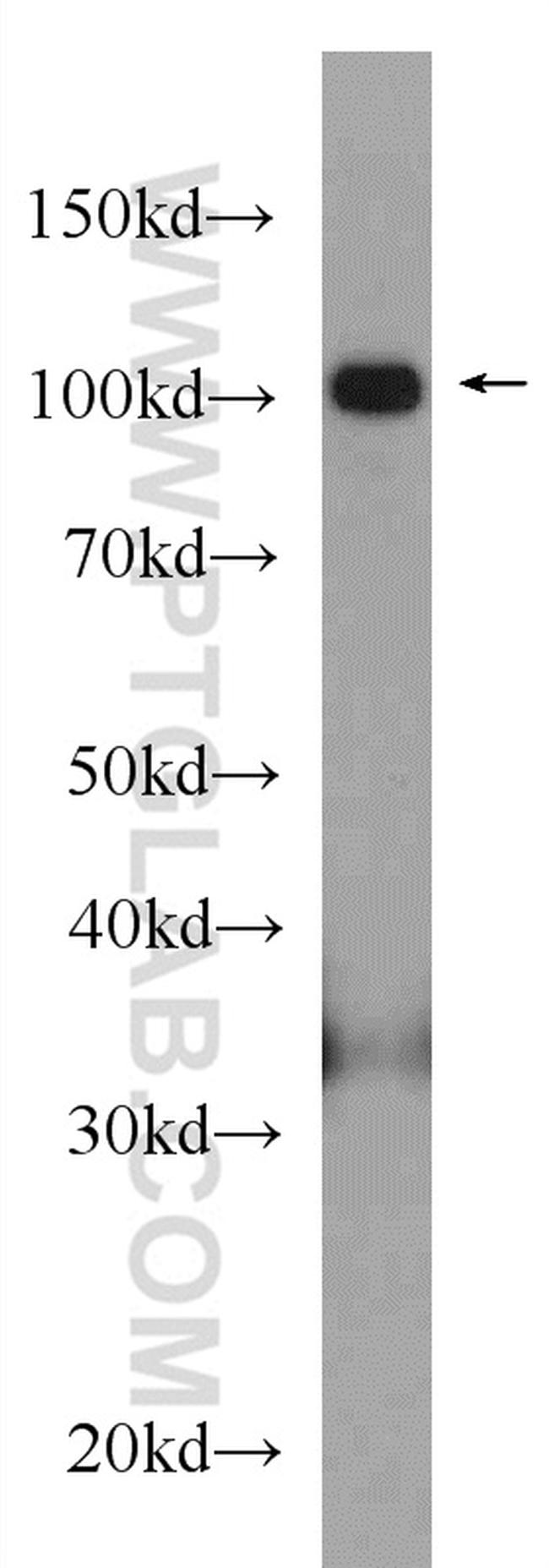 OGT Antibody in Western Blot (WB)