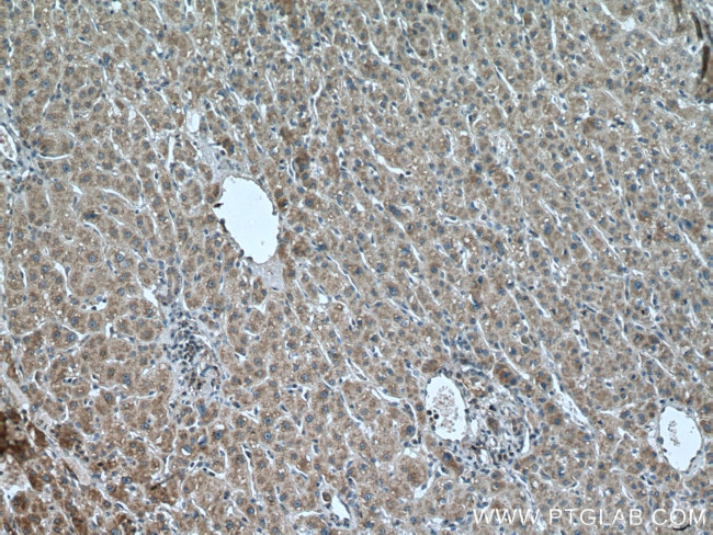 LIAS Antibody in Immunohistochemistry (Paraffin) (IHC (P))