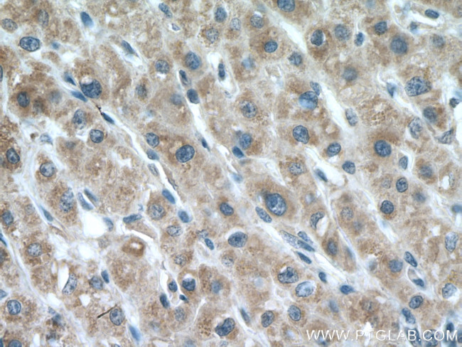 LIAS Antibody in Immunohistochemistry (Paraffin) (IHC (P))