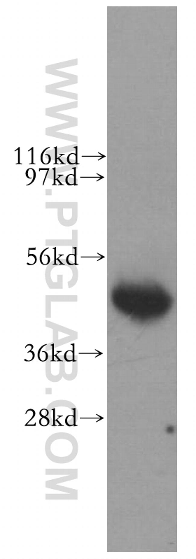 LIAS Antibody in Western Blot (WB)