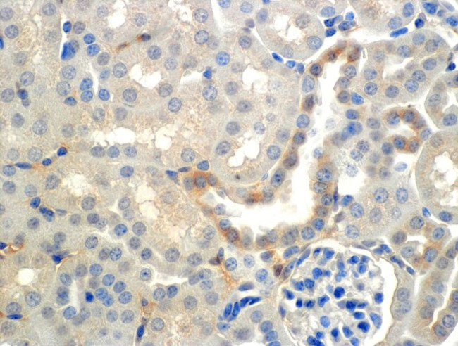 ENaC beta Antibody in Immunohistochemistry (IHC)