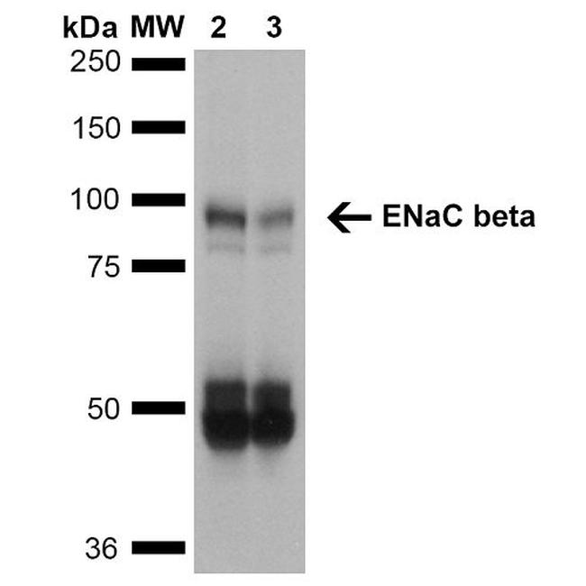 ENaC beta Antibody in Western Blot (WB)