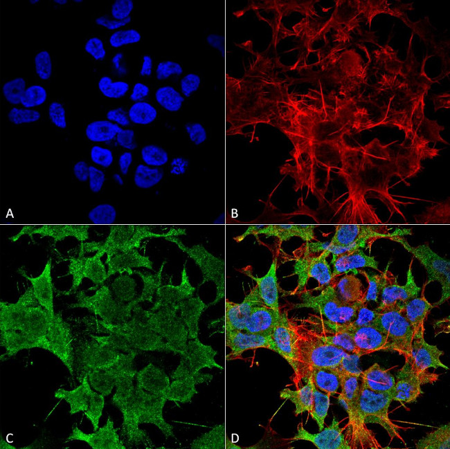 TASK1 Potassium Channel Antibody in Immunocytochemistry (ICC/IF)