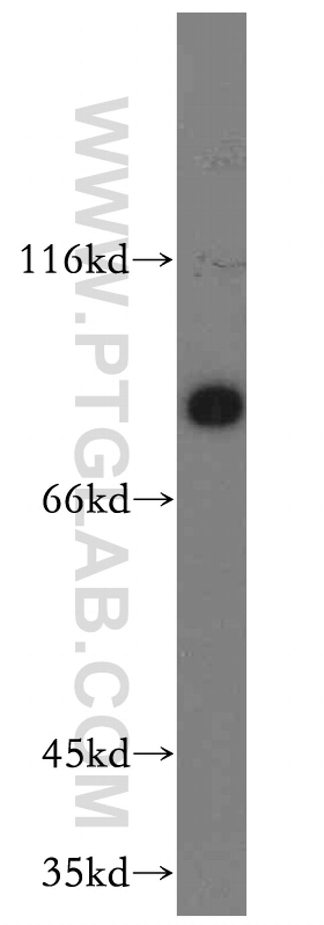 SCIN Antibody in Western Blot (WB)