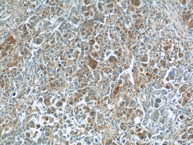 TNS4 Antibody in Immunohistochemistry (Paraffin) (IHC (P))