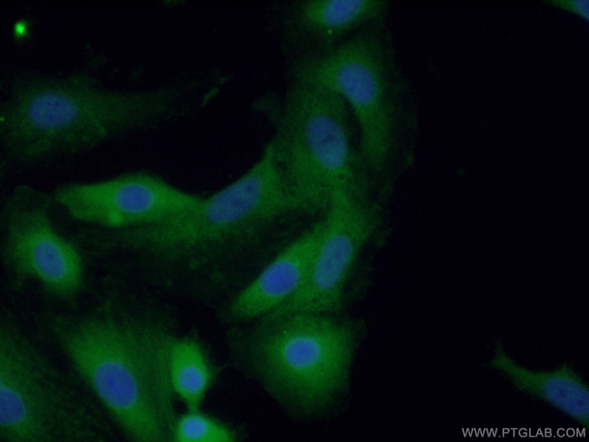 TNS4 Antibody in Immunocytochemistry (ICC/IF)