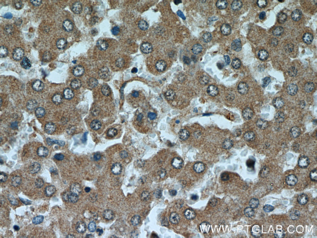 MTRF1 Antibody in Immunohistochemistry (Paraffin) (IHC (P))