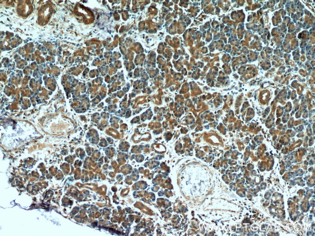 MTRF1 Antibody in Immunohistochemistry (Paraffin) (IHC (P))