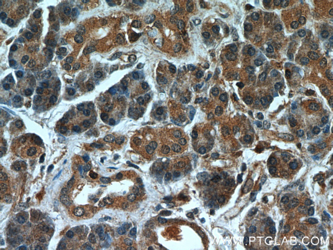 MTRF1 Antibody in Immunohistochemistry (Paraffin) (IHC (P))