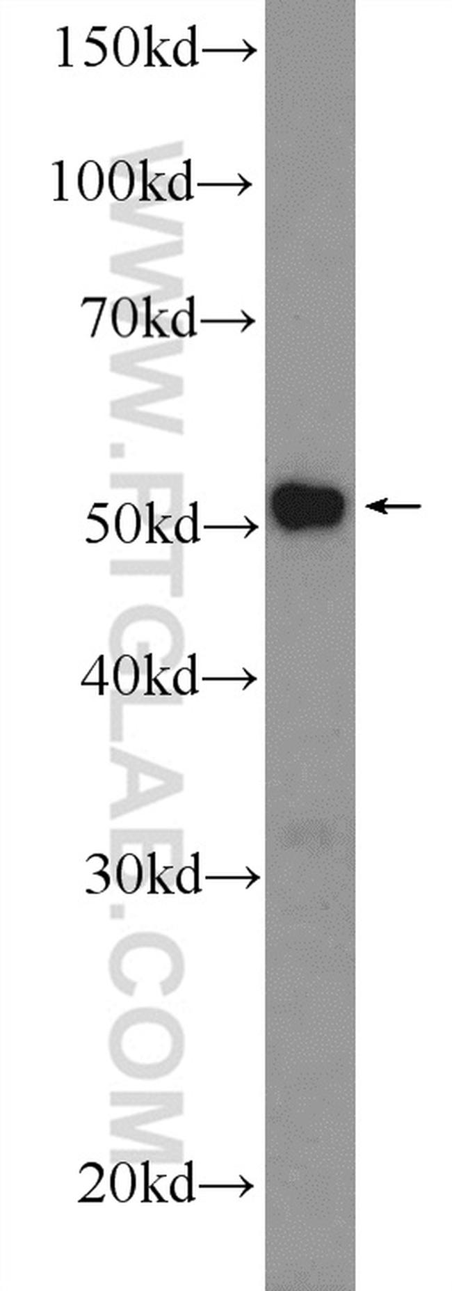 MTRF1 Antibody in Western Blot (WB)