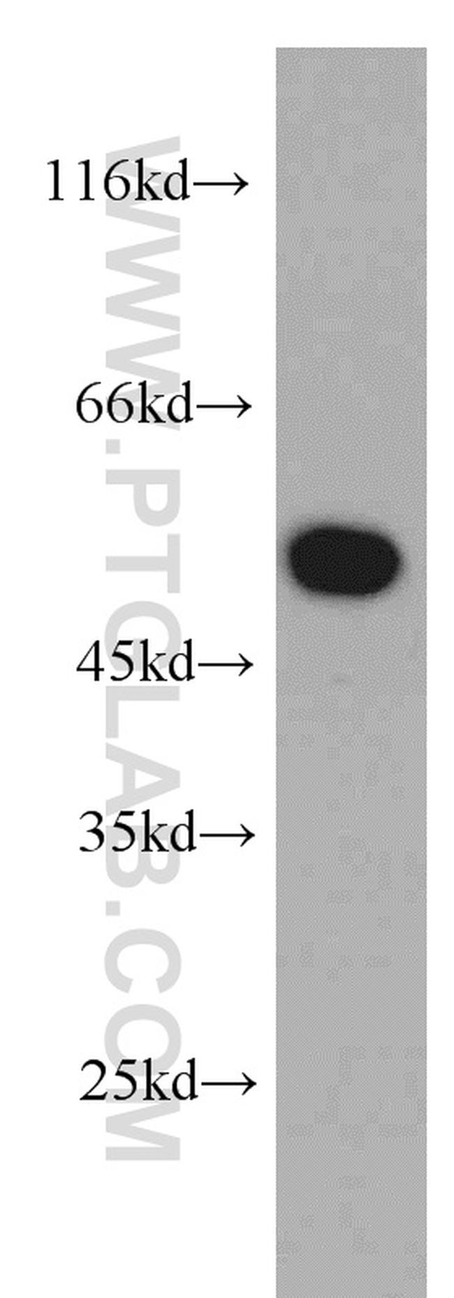 MTRF1 Antibody in Western Blot (WB)