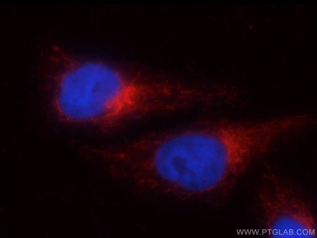 GRP78/BIP Antibody in Immunocytochemistry (ICC/IF)