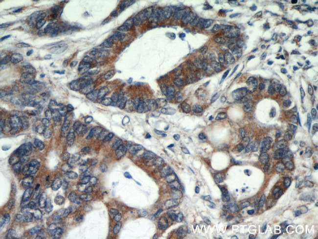 GRP78/BIP Antibody in Immunohistochemistry (Paraffin) (IHC (P))