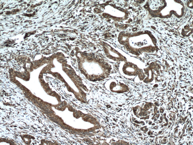 GRP78/BIP Antibody in Immunohistochemistry (Paraffin) (IHC (P))