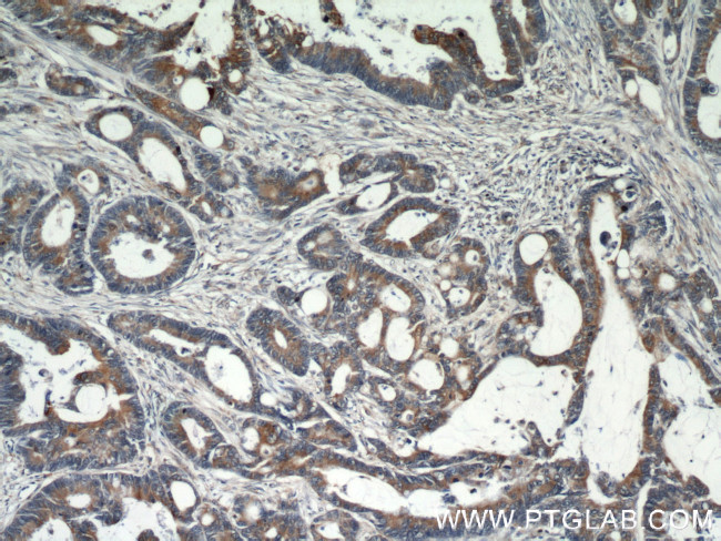 GRP78/BIP Antibody in Immunohistochemistry (Paraffin) (IHC (P))